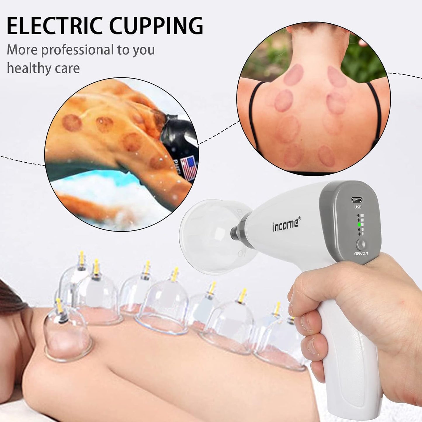 Portable Electric Cupping Therapy Set - Home Massage Kit with Vacuum Suction Cups for Ultimate Relaxation and Pain Relief