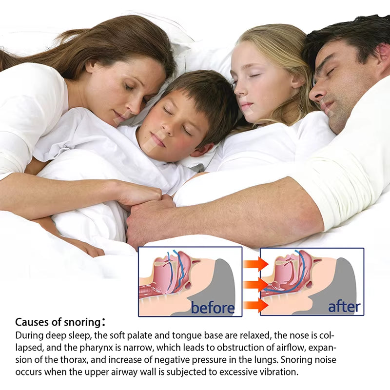 Sleep Strip - Enhance Nose Breathing & Reduce Snoring for Adults & Children