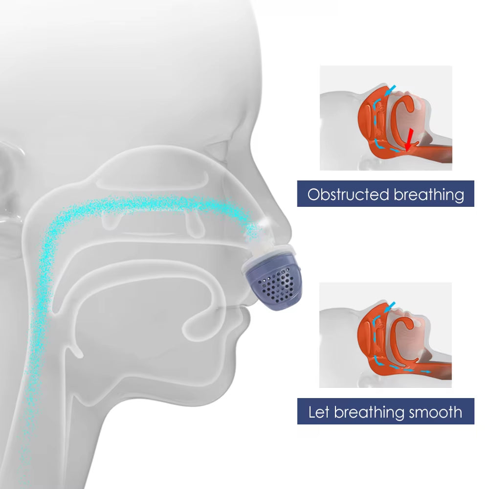 Revolutionary Electric Anti-Snoring Device - Silicone Nasal Clip for Better Sleep and Anxiety Relief
